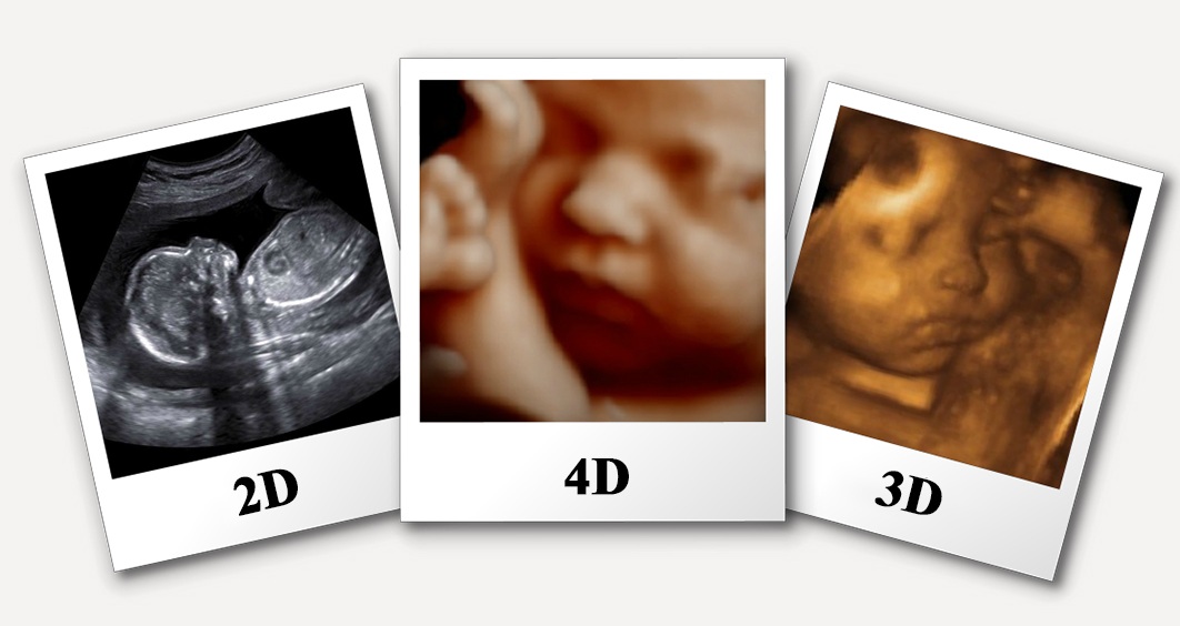 4D sonography centre in Gujarat