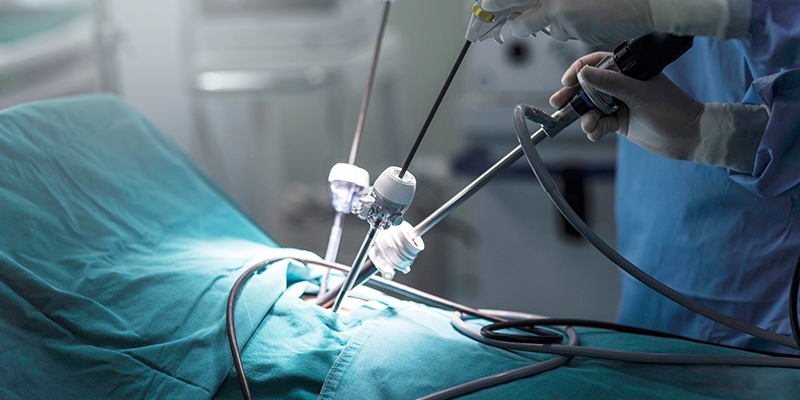 Laparoscopic treatment in Gujarat